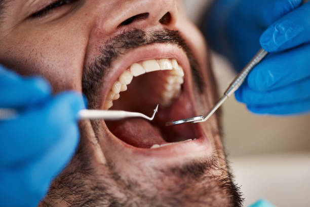 Best After-Hours Emergency Dentist in Red Rock, AZ